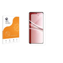 Anti-Glare Screen Protector for Xiaomi Redmi Note 15 Special Edition