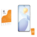 3pk Optic+ Anti-Glare Screen Protectors for Honor Play 7T Pro